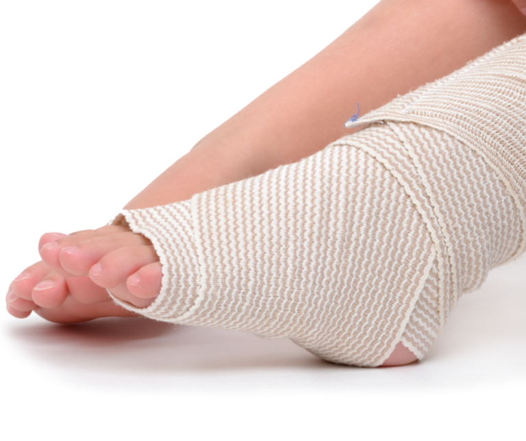3 Common Ankle Injuries