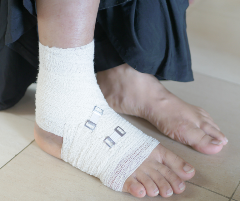 3 Kinds of Foot Trauma to Take to Your Podiatrist for Emergency Care